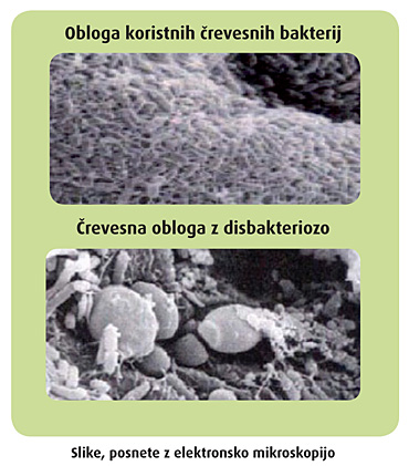 povecana prostata sintomi
